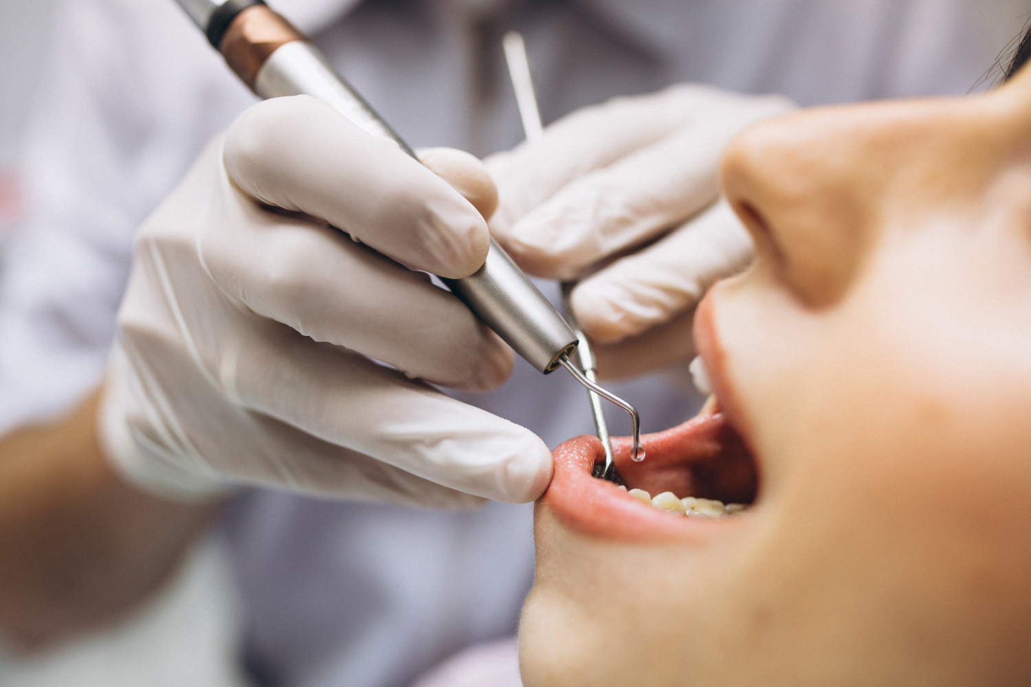 Periodontologia - od pierwszych objawów do stabilnych dziąseł na lata