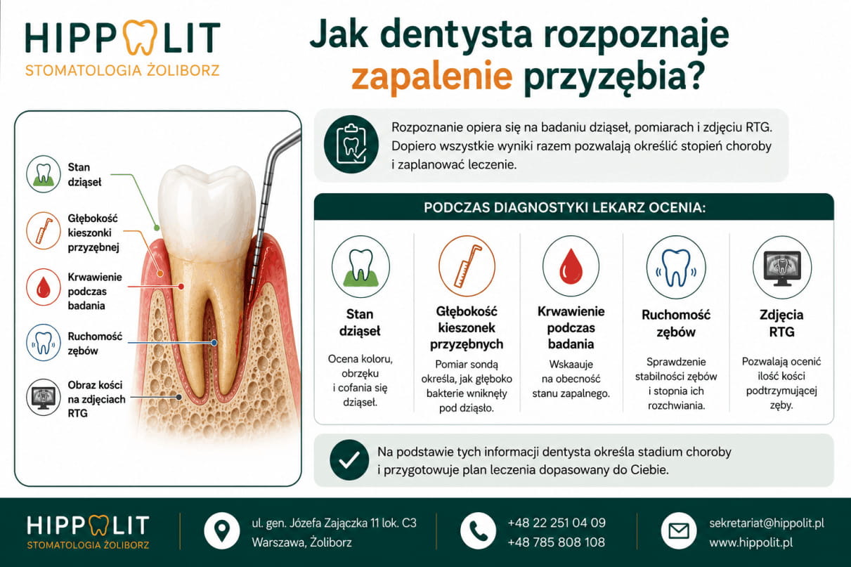 Jak dentysta rozpoznaje zapalenie przyzębia Jak dentysta rozpoznaje zapalenie przyzębia