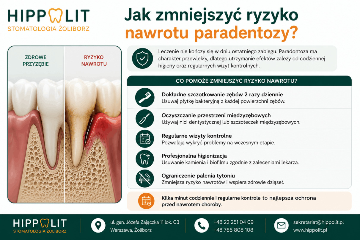 Jak zmniejszyć ryzyko nawrotu paradontozy Jak zmniejszyć ryzyko nawrotu paradontozy