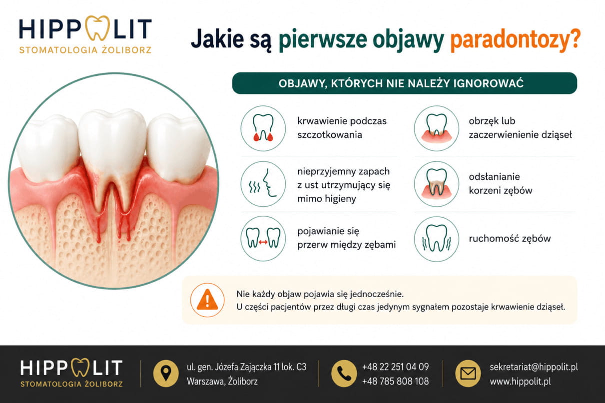 Jakie są pierwsze objawy paradontozy Jakie są pierwsze objawy paradontozy