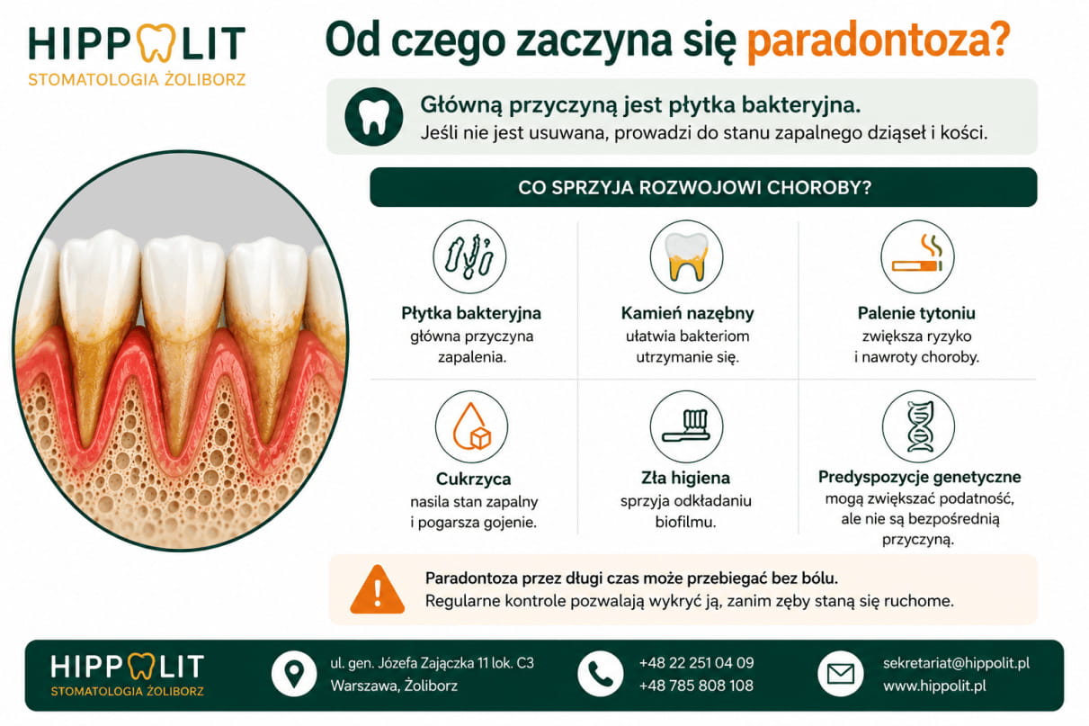 Od czego zaczyna się paradontoza Od czego zaczyna się paradontoza