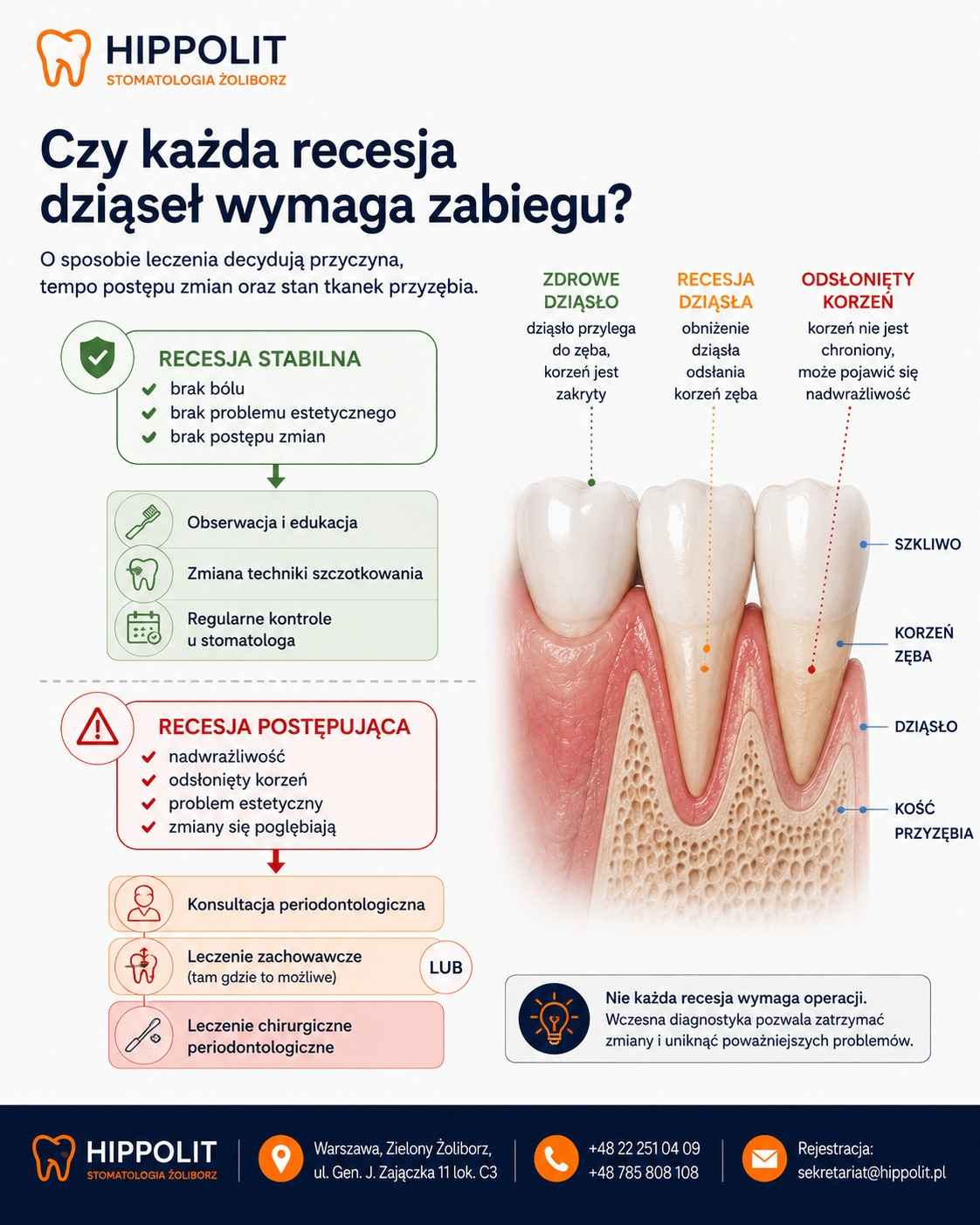 Leczenie recesji dziąseł w Gabinecie Stomatologicznym HIPPOLIT w Warszawie na Żoliborzu, zapraszamy. Czy każda recesja dziąseł wymaga zabiegu